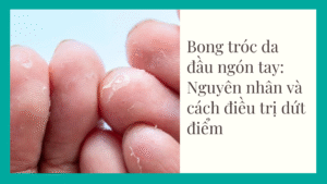 Bong tróc da đầu ngón tay: Nguyên nhân và cách điều trị dứt điểm