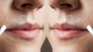 Cách trị thâm ở mép môi